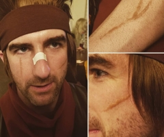 Fighter Scars