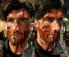 "Billy Russo" Lacerations