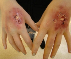 Zombie Hands
