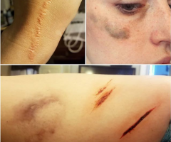 Assortment of injuries